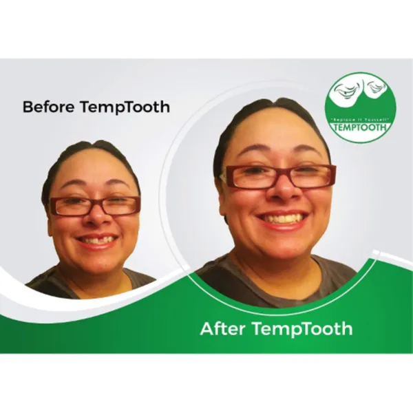 Temptooth Temporary Tooth Replacement Product With Dental Tools Wholesale Tradeling