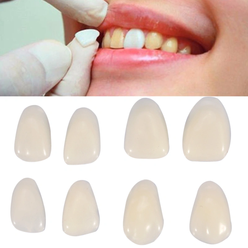 70PCS/Bag Teeth Veneers Resin Anterior Upper Temporary Crown For Dental
